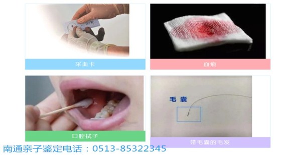南通亲子鉴定：科学守护亲情，专业解答血缘疑惑